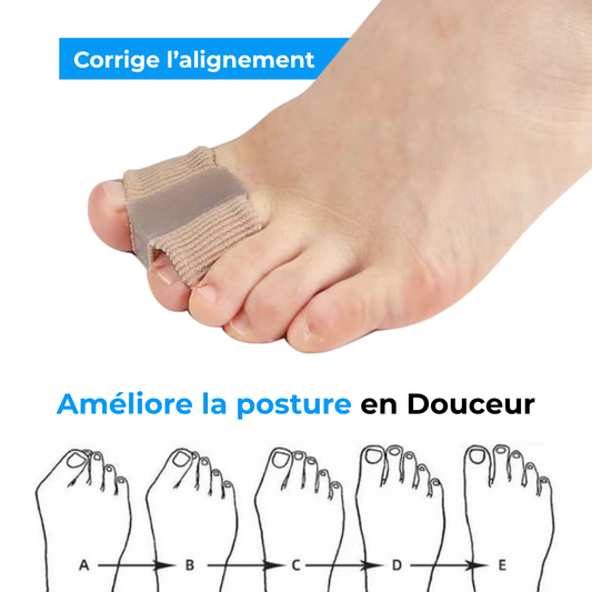Orthèse de Correction